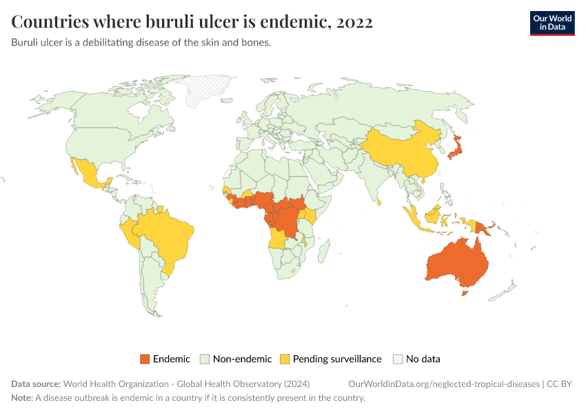 A thumbnail of the "Countries where buruli ulcer is endemic" chart