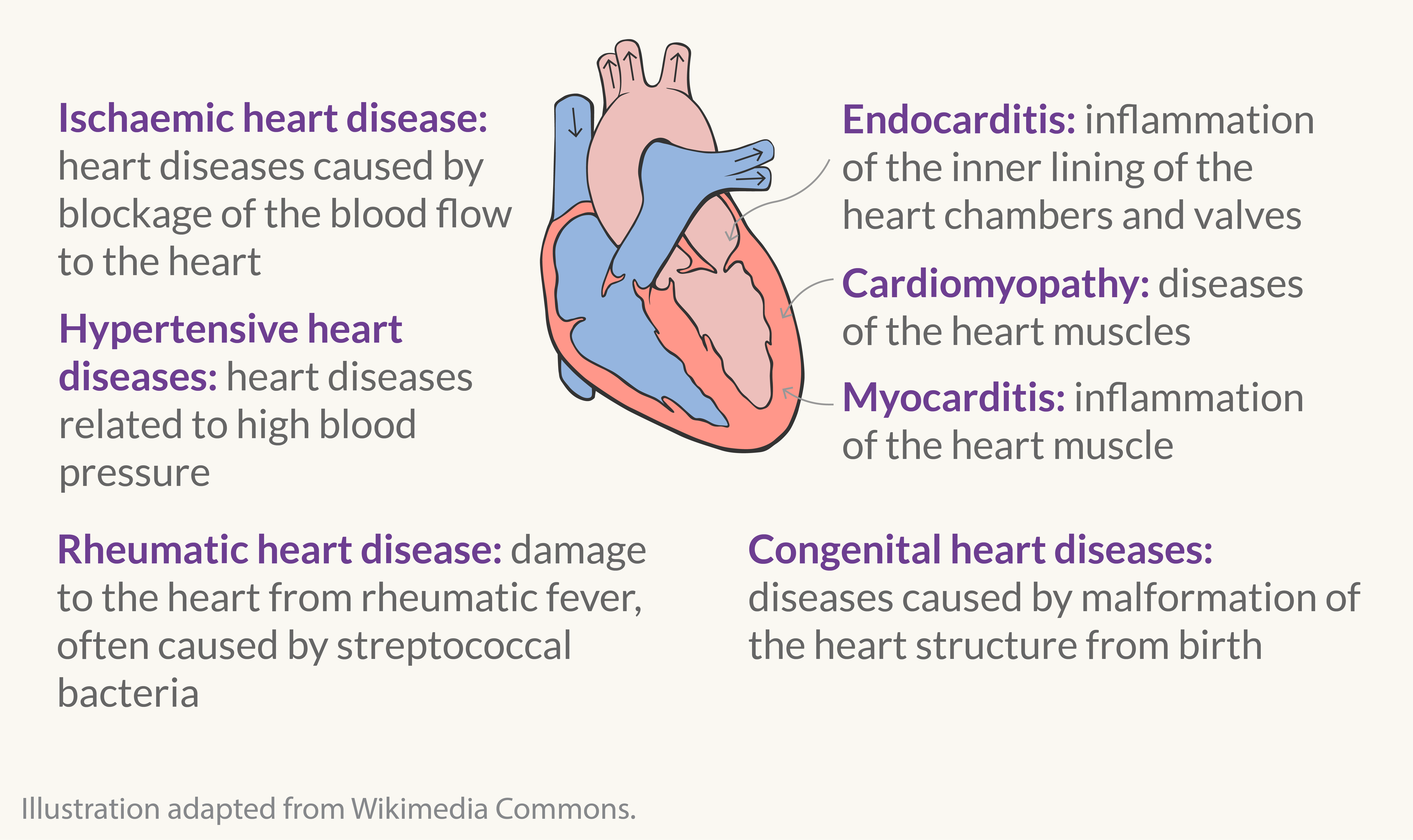 Illustration of cardiovascular diseases of the heart